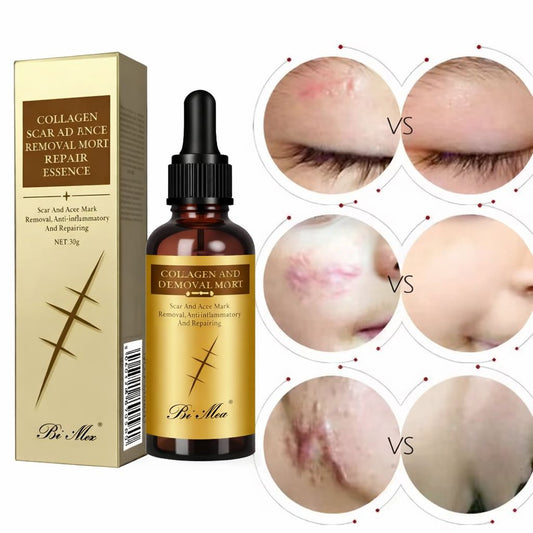 GEL ANTI CICATRICES