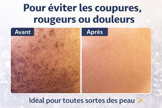 EPILATEUR ELETRIQUE